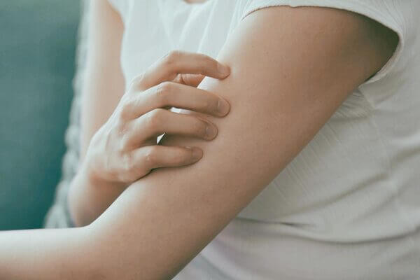 犬のノミは人間にも寄生する