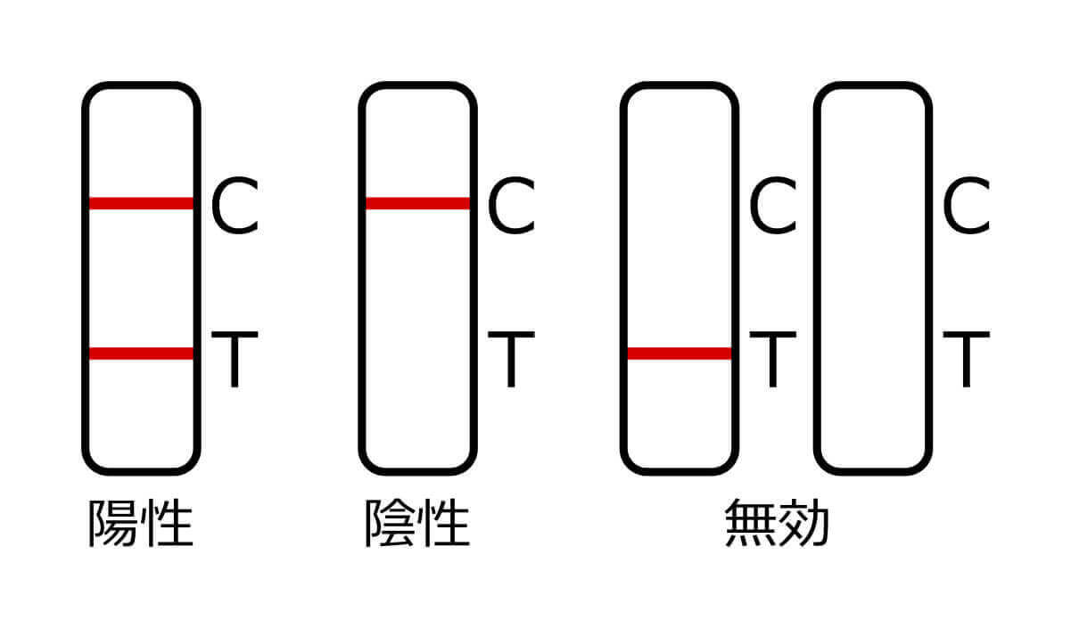 検査結果の判定基準